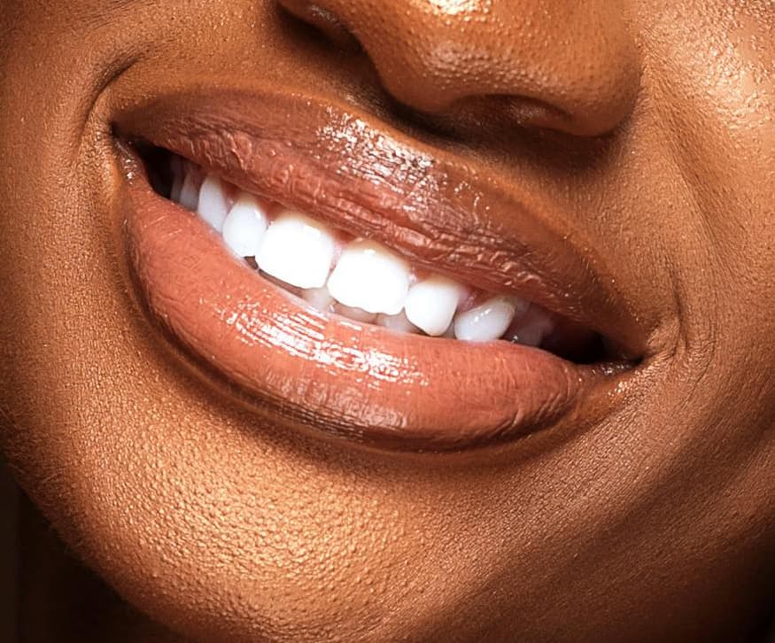 Woman with glossy lips